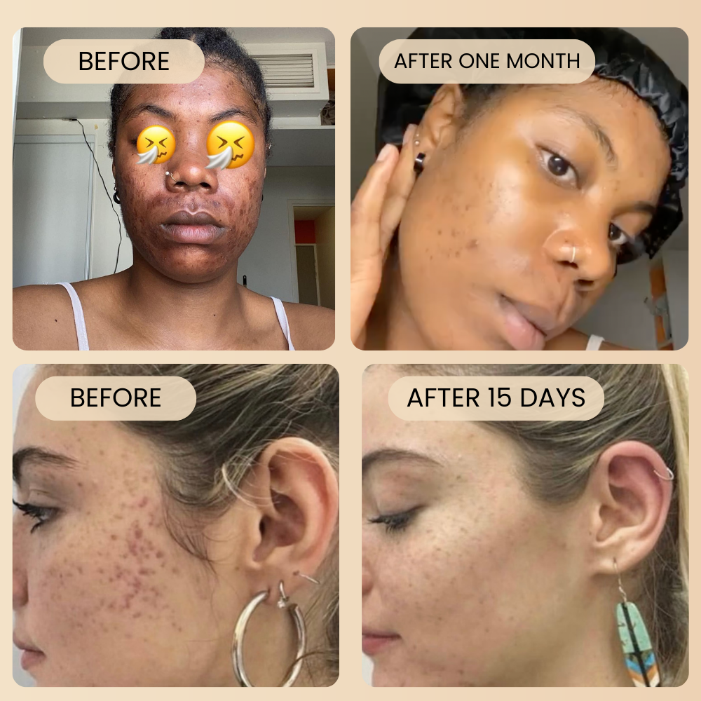 Turmeric & Vitamin C Serum